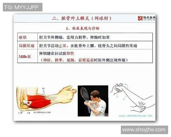 科学网球速度训练方法提升运动表现的有效策略与技巧探讨 科学网球速度训练方法提升运动表现的有效策略与技巧探讨